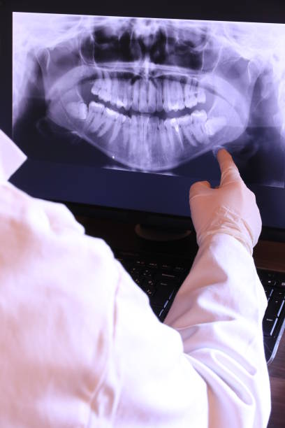 Best Emergency Dentist for Knocked-Out Tooth in Moraga, CA